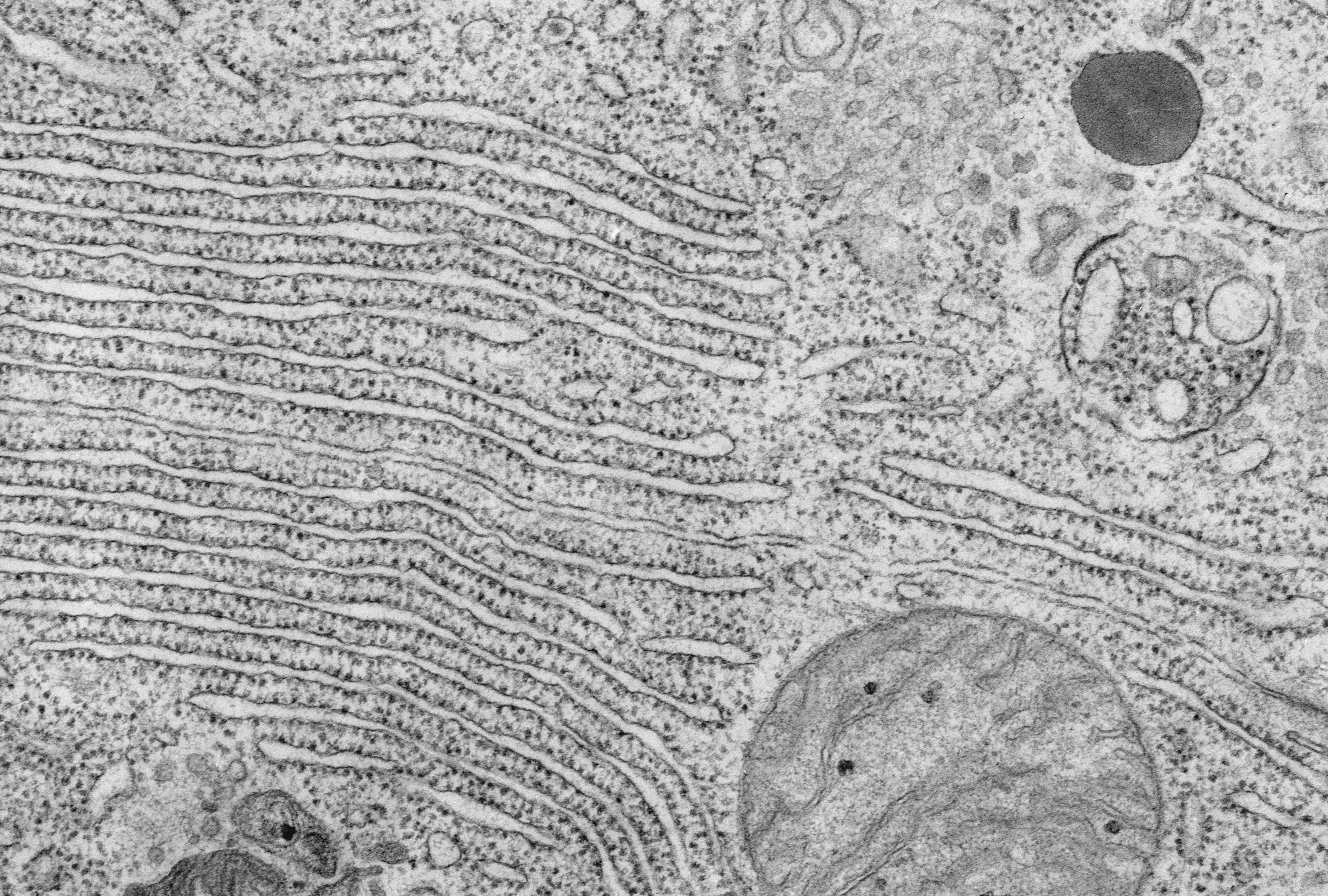 Endoplasmic Reticulum Electron Micrograph