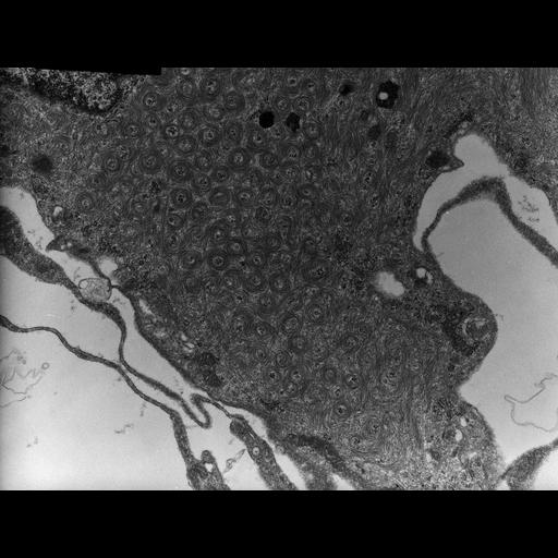  NCBI Organism:Rana catesbeiana; Cell Types:barrier epithelial cell Cell Components:intermediate filament cytoskeleton, plasma membrane; Biological process:intermediate filament cytoskeleton organization