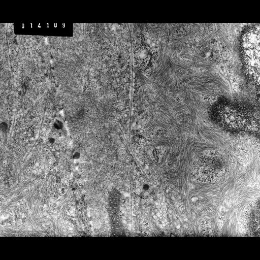  NCBI Organism:Rana catesbeiana; Cell Types:barrier epithelial cell Cell Components:intermediate filament cytoskeleton, plasma membrane; Biological process:intermediate filament cytoskeleton organization