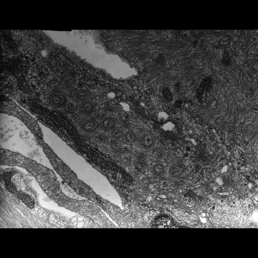  NCBI Organism:Rana catesbeiana; Cell Types:barrier epithelial cell Cell Components:intermediate filament cytoskeleton, plasma membrane; Biological process:intermediate filament cytoskeleton organization