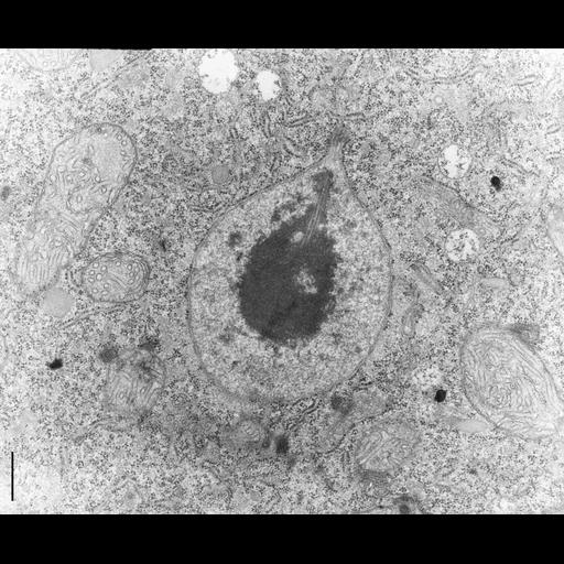  NCBI Organism:Didinium nasutum; Cell Types:cell by organism, eukaryotic cell, , ; Cell Components:micronucleus, nuclear heterochromatin, condensed nuclear chromosome, nuclear envelope, spindle microtubule; Biological process:mitotic anaphase