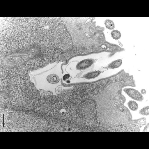  NCBI Organism:Didinium nasutum; Cell Types:eukaryotic cell, , ; Cell Components:contractile vacuole pore, cell cortex, cell cortex part; Biological process:water transport, ;