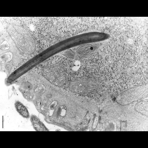  NCBI Organism:Didinium nasutum; Cell Types:eukaryotic cell, , ; Cell Components:cell cortex, , , ; Biological process:, , ;