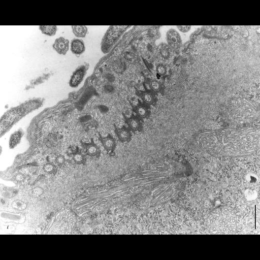  NCBI Organism:Didinium nasutum; Cell Types:eukaryotic cell, , ; Cell Components:cell cortex, cilium, microtubule basal body, ciliary rootlet, ; Biological process:ciliary cell motility, microtubule cytoskeleton organization, , detection of symbiotic bacterium;