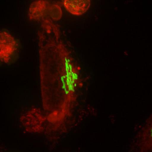  NCBI Organism:Homo sapiens; Cell Types:permanent cell line cell, epithelial cell; Cell Components:Golgi apparatus, endoplasmic reticulum; Biological process:Golgi organization