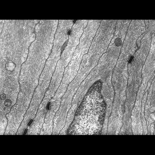  NCBI Organism:Rana catesbeiana; Cell Types:barrier epithelial cell Cell Components:intermediate filament cytoskeleton, plasma membrane; Biological process:intermediate filament cytoskeleton organization