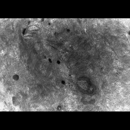  NCBI Organism:Rana catesbeiana; Cell Types:barrier epithelial cell Cell Components:intermediate filament cytoskeleton, plasma membrane; Biological process:intermediate filament cytoskeleton organization