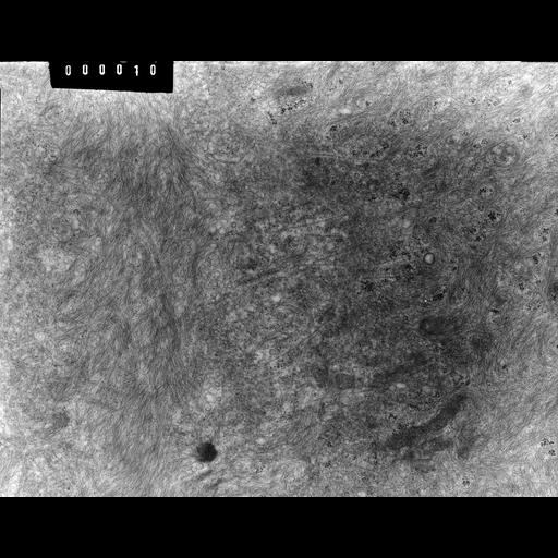  NCBI Organism:Rana catesbeiana; Cell Types:barrier epithelial cell Cell Components:intermediate filament cytoskeleton, plasma membrane; Biological process:intermediate filament cytoskeleton organization