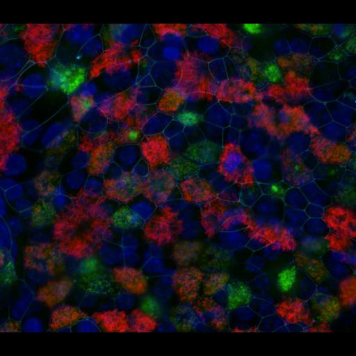  NCBI Organism:Mus musculus; Cell Types:tracheal epithelial cell Cell Components:cell-cell junction, microtubule basal body, nucleus, ; Biological process:lung ciliated cell differentiation