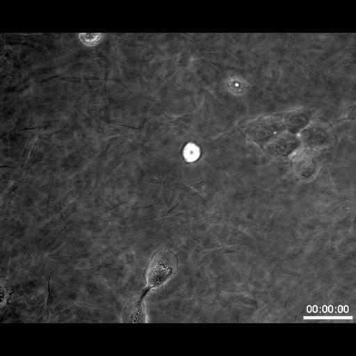  NCBI Organism:Homo sapiens; Cell Types:epithelial cell Cell Components:cell, extracellular matrix; Biological process:cell migration