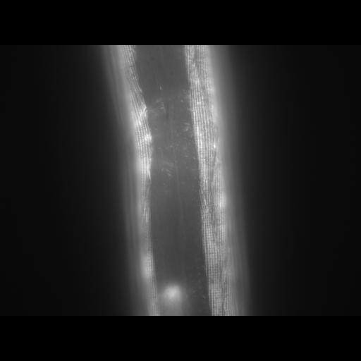  NCBI Organism:Caenorhabditis elegans; Cell Types:muscle cell Cell Components:actin filament Biological process:chronological cell aging