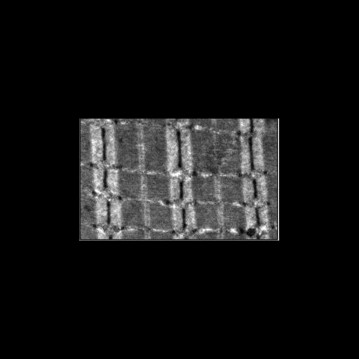  NCBI Organism:Mus musculus; Cell Types:skeletal muscle cell Cell Components:striated muscle thin filament, striated muscle myosin thick filament, myofibril; Biological process:skeletal muscle contraction