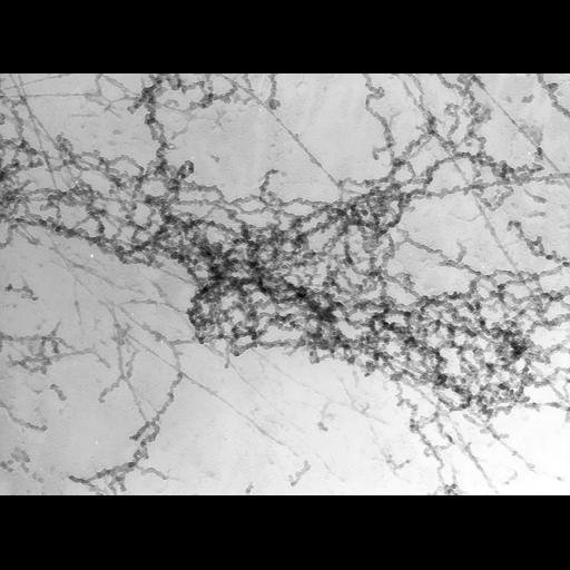  Cell Types:erythrocyte Cell Components:nuclear chromatin