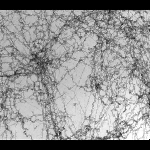  Cell Types:erythrocyte Cell Components:nuclear chromatin