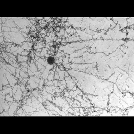  Cell Types:erythrocyte Cell Components:nuclear chromatin