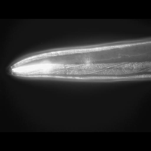  NCBI Organism:Caenorhabditis elegans; Cell Types:muscle cell Cell Components:actin filament Biological process:chronological cell aging