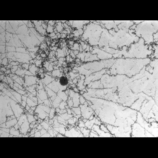  Cell Types:erythrocyte Cell Components:nuclear chromatin