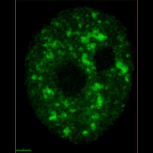  NCBI Organism:Homo sapiens; Cell Components:nucleus Biological process:RNA splicing, RNA metabolic process;