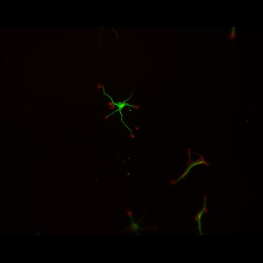  NCBI Organism:Rattus; Cell Types:multipolar neuron Cell Components:cytoskeleton, microtubule cytoskeleton, actin cytoskeleton, axon, dendrite, dendritic growth cone, axonal growth cone, lamellipodium, filopodium; Biological process:developmental process, dendrite development, establishment or maintenance of cell polarity;