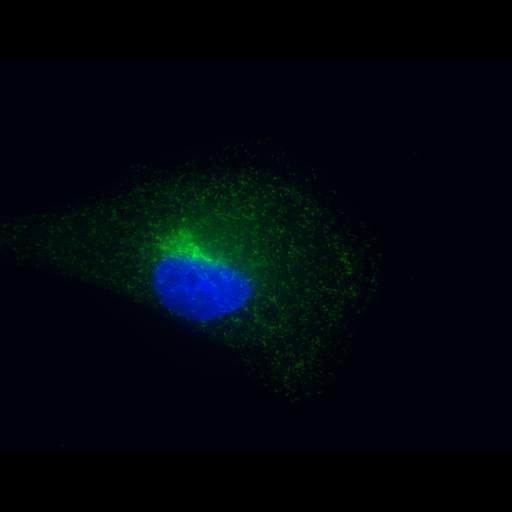  NCBI Organism:Homo sapiens; Cell Types:epithelial cell Cell Components:clathrin coat, nucleus;