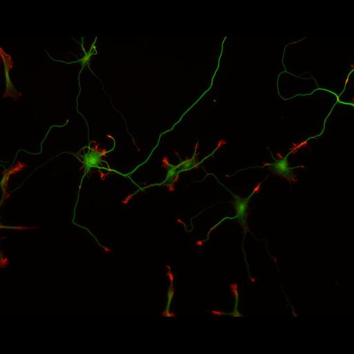  NCBI Organism:Rattus; Cell Types:multipolar neuron Cell Components:cytoskeleton, microtubule cytoskeleton, actin cytoskeleton, axon, dendrite, dendritic growth cone, axonal growth cone, lamellipodium, filopodium; Biological process:developmental process, dendrite development, establishment or maintenance of cell polarity;