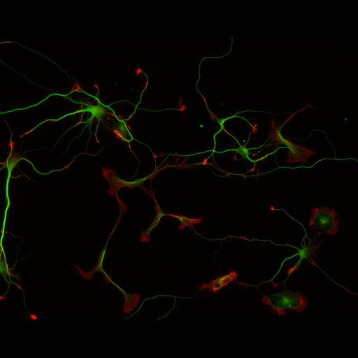  NCBI Organism:Rattus; Cell Types:multipolar neuron Cell Components:cytoskeleton, microtubule cytoskeleton, actin cytoskeleton, axon, dendrite, dendritic growth cone, axonal growth cone, lamellipodium, filopodium; Biological process:developmental process, dendrite development, establishment or maintenance of cell polarity;