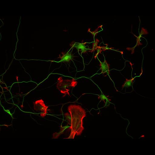  NCBI Organism:Rattus; Cell Types:multipolar neuron Cell Components:cytoskeleton, microtubule cytoskeleton, actin cytoskeleton, axon, dendrite, dendritic growth cone, axonal growth cone, lamellipodium, filopodium; Biological process:developmental process, dendrite development, establishment or maintenance of cell polarity;