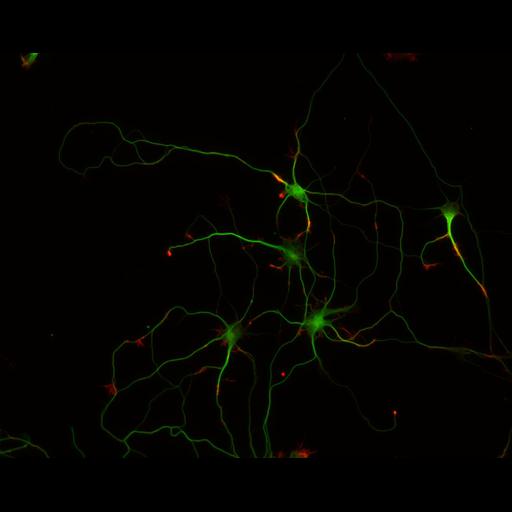  NCBI Organism:Rattus; Cell Types:multipolar neuron Cell Components:cytoskeleton, microtubule cytoskeleton, actin cytoskeleton, axon, dendrite, dendritic growth cone, axonal growth cone, lamellipodium, filopodium; Biological process:developmental process, dendrite development, establishment or maintenance of cell polarity;