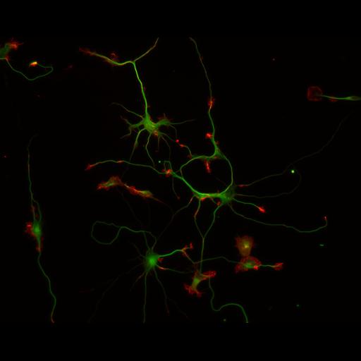  NCBI Organism:Rattus; Cell Types:multipolar neuron Cell Components:cytoskeleton, microtubule cytoskeleton, actin cytoskeleton, axon, dendrite, dendritic growth cone, axonal growth cone, lamellipodium, filopodium; Biological process:developmental process, dendrite development, establishment or maintenance of cell polarity;