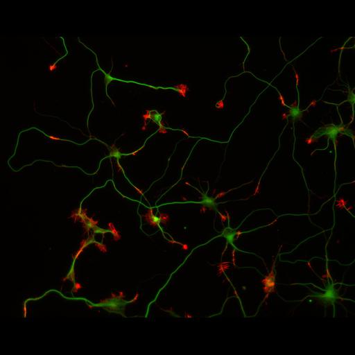  NCBI Organism:Rattus; Cell Types:multipolar neuron Cell Components:cytoskeleton, microtubule cytoskeleton, actin cytoskeleton, axon, dendrite, dendritic growth cone, axonal growth cone, lamellipodium, filopodium; Biological process:developmental process, dendrite development, establishment or maintenance of cell polarity;