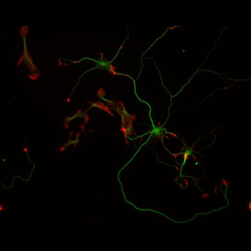  NCBI Organism:Rattus; Cell Types:multipolar neuron Cell Components:cytoskeleton, microtubule cytoskeleton, actin cytoskeleton, axon, dendrite, dendritic growth cone, axonal growth cone, lamellipodium, filopodium; Biological process:developmental process, dendrite development, establishment or maintenance of cell polarity;