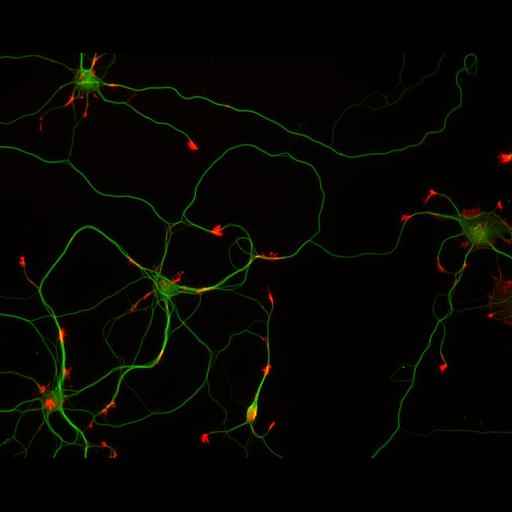  NCBI Organism:Rattus; Cell Types:multipolar neuron Cell Components:cytoskeleton, microtubule cytoskeleton, actin cytoskeleton, axon, dendrite, dendritic growth cone, axonal growth cone, lamellipodium, filopodium; Biological process:developmental process, dendrite development, establishment or maintenance of cell polarity;