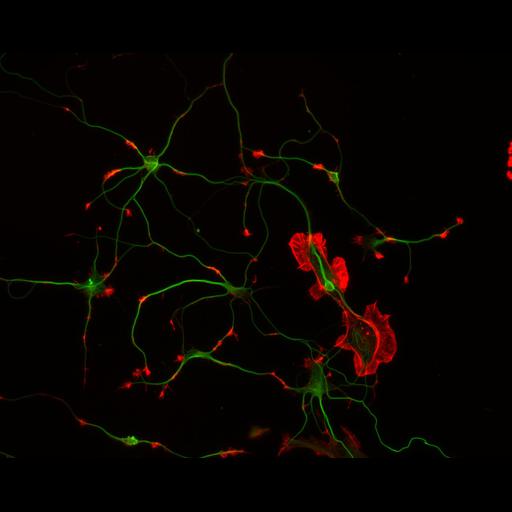  NCBI Organism:Rattus; Cell Types:multipolar neuron Cell Components:cytoskeleton, microtubule cytoskeleton, actin cytoskeleton, axon, dendrite, dendritic growth cone, axonal growth cone, lamellipodium, filopodium; Biological process:developmental process, dendrite development, establishment or maintenance of cell polarity;