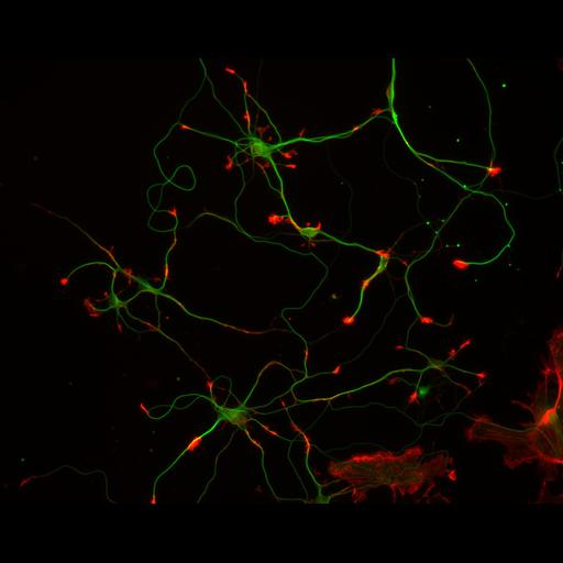  NCBI Organism:Rattus; Cell Types:multipolar neuron Cell Components:cytoskeleton, microtubule cytoskeleton, actin cytoskeleton, axon, dendrite, dendritic growth cone, axonal growth cone, lamellipodium, filopodium; Biological process:developmental process, dendrite development, establishment or maintenance of cell polarity;