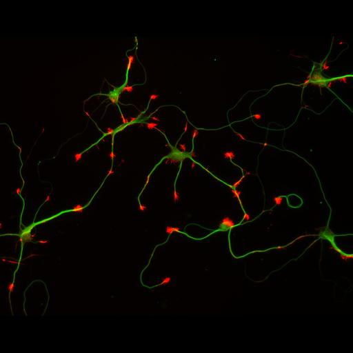  NCBI Organism:Rattus; Cell Types:multipolar neuron Cell Components:cytoskeleton, microtubule cytoskeleton, actin cytoskeleton, axon, dendrite, dendritic growth cone, axonal growth cone, lamellipodium, filopodium; Biological process:developmental process, dendrite development, establishment or maintenance of cell polarity;