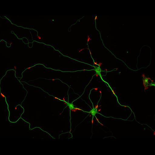  NCBI Organism:Rattus; Cell Types:multipolar neuron Cell Components:cytoskeleton, microtubule cytoskeleton, actin cytoskeleton, axon, dendrite, dendritic growth cone, axonal growth cone, lamellipodium, filopodium; Biological process:developmental process, dendrite development, establishment or maintenance of cell polarity;