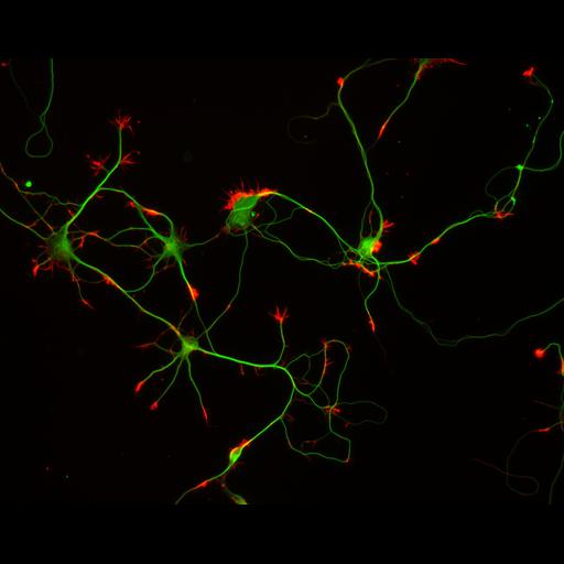  NCBI Organism:Rattus; Cell Types:multipolar neuron Cell Components:cytoskeleton, microtubule cytoskeleton, actin cytoskeleton, axon, dendrite, dendritic growth cone, axonal growth cone, lamellipodium, filopodium; Biological process:developmental process, dendrite development, establishment or maintenance of cell polarity;