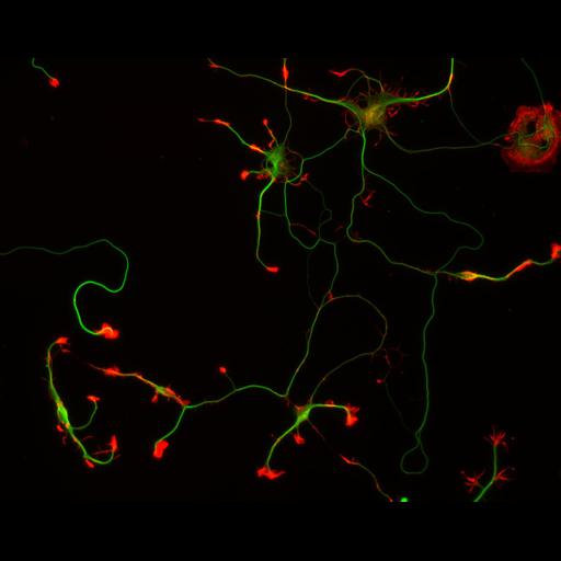  NCBI Organism:Rattus; Cell Types:multipolar neuron Cell Components:cytoskeleton, microtubule cytoskeleton, actin cytoskeleton, axon, dendrite, dendritic growth cone, axonal growth cone, lamellipodium, filopodium; Biological process:developmental process, dendrite development, establishment or maintenance of cell polarity;