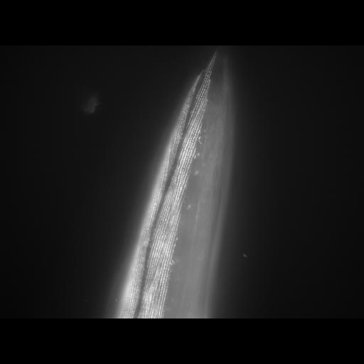  NCBI Organism:Caenorhabditis elegans; Cell Types:muscle cell Cell Components:actin filament Biological process:chronological cell aging