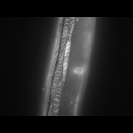  NCBI Organism:Caenorhabditis elegans; Cell Types:muscle cell Cell Components:actin filament Biological process:chronological cell aging