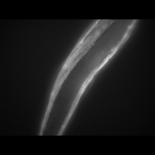  NCBI Organism:Caenorhabditis elegans; Cell Types:muscle cell Cell Components:actin filament Biological process:chronological cell aging