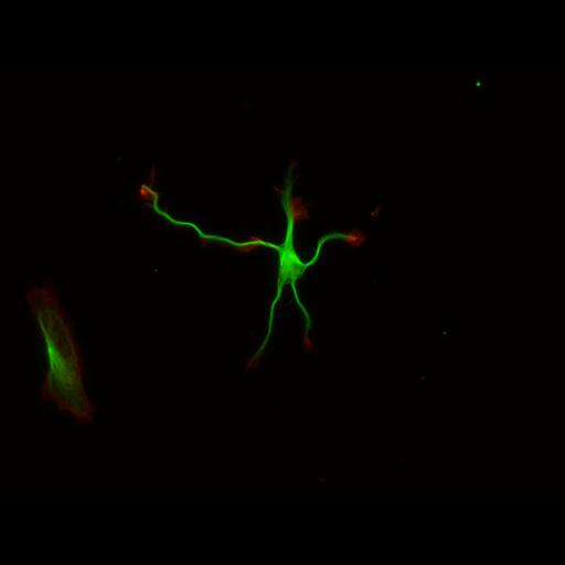  NCBI Organism:Rattus; Cell Types:multipolar neuron Cell Components:cytoskeleton, microtubule cytoskeleton, actin cytoskeleton, axon, dendrite, dendritic growth cone, axonal growth cone, lamellipodium, filopodium; Biological process:developmental process, dendrite development, establishment or maintenance of cell polarity;