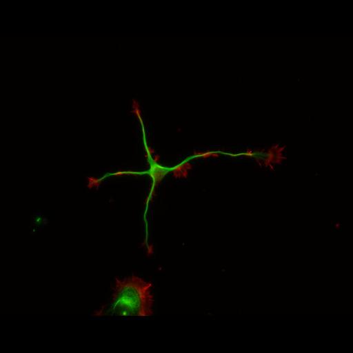  NCBI Organism:Rattus; Cell Types:multipolar neuron Cell Components:cytoskeleton, microtubule cytoskeleton, actin cytoskeleton, axon, dendrite, dendritic growth cone, axonal growth cone, lamellipodium, filopodium; Biological process:developmental process, dendrite development, establishment or maintenance of cell polarity;