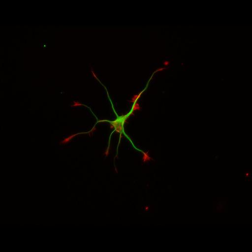  NCBI Organism:Rattus; Cell Types:multipolar neuron Cell Components:cytoskeleton, microtubule cytoskeleton, actin cytoskeleton, axon, dendrite, dendritic growth cone, axonal growth cone, lamellipodium, filopodium; Biological process:developmental process, dendrite development, establishment or maintenance of cell polarity;