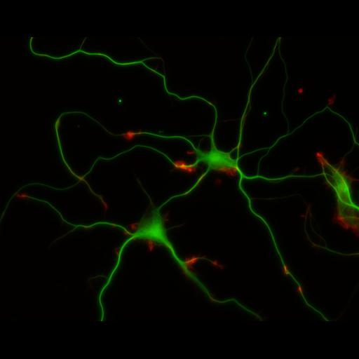  NCBI Organism:Rattus; Cell Types:multipolar neuron Cell Components:cytoskeleton, microtubule cytoskeleton, actin cytoskeleton, axon, dendrite, dendritic growth cone, axonal growth cone, lamellipodium, filopodium; Biological process:developmental process, dendrite development, establishment or maintenance of cell polarity;