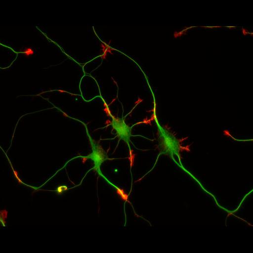  NCBI Organism:Rattus; Cell Types:multipolar neuron Cell Components:cytoskeleton, microtubule cytoskeleton, actin cytoskeleton, axon, dendrite, dendritic growth cone, axonal growth cone, lamellipodium, filopodium; Biological process:developmental process, dendrite development, establishment or maintenance of cell polarity;