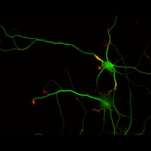  NCBI Organism:Rattus; Cell Types:multipolar neuron Cell Components:cytoskeleton, microtubule cytoskeleton, actin cytoskeleton, axon, dendrite, dendritic growth cone, axonal growth cone, lamellipodium, filopodium; Biological process:developmental process, dendrite development, establishment or maintenance of cell polarity;