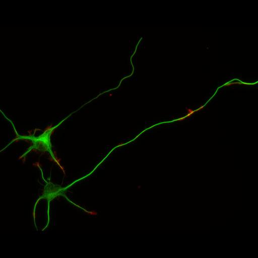  NCBI Organism:Rattus; Cell Types:multipolar neuron Cell Components:cytoskeleton, microtubule cytoskeleton, actin cytoskeleton, axon, dendrite, dendritic growth cone, axonal growth cone, lamellipodium, filopodium; Biological process:developmental process, dendrite development, establishment or maintenance of cell polarity;