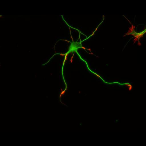  NCBI Organism:Rattus; Cell Types:multipolar neuron Cell Components:cytoskeleton, microtubule cytoskeleton, actin cytoskeleton, axon, dendrite, dendritic growth cone, axonal growth cone, lamellipodium, filopodium; Biological process:developmental process, dendrite development, establishment or maintenance of cell polarity;