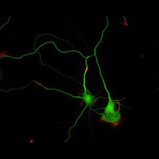  NCBI Organism:Rattus; Cell Types:multipolar neuron Cell Components:cytoskeleton, microtubule cytoskeleton, actin cytoskeleton, axon, dendrite, dendritic growth cone, axonal growth cone, lamellipodium, filopodium; Biological process:developmental process, dendrite development, establishment or maintenance of cell polarity;